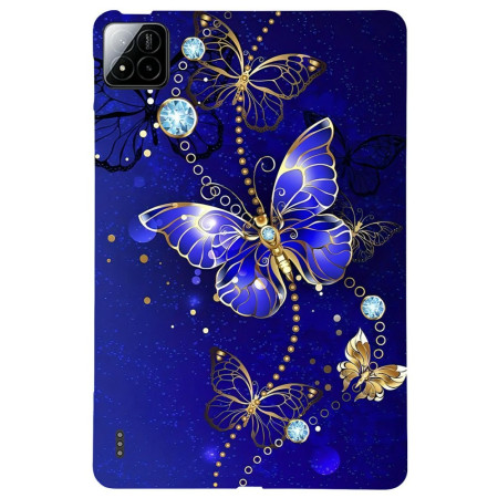 Coque Xiaomi Pad 7 / Pad 7...