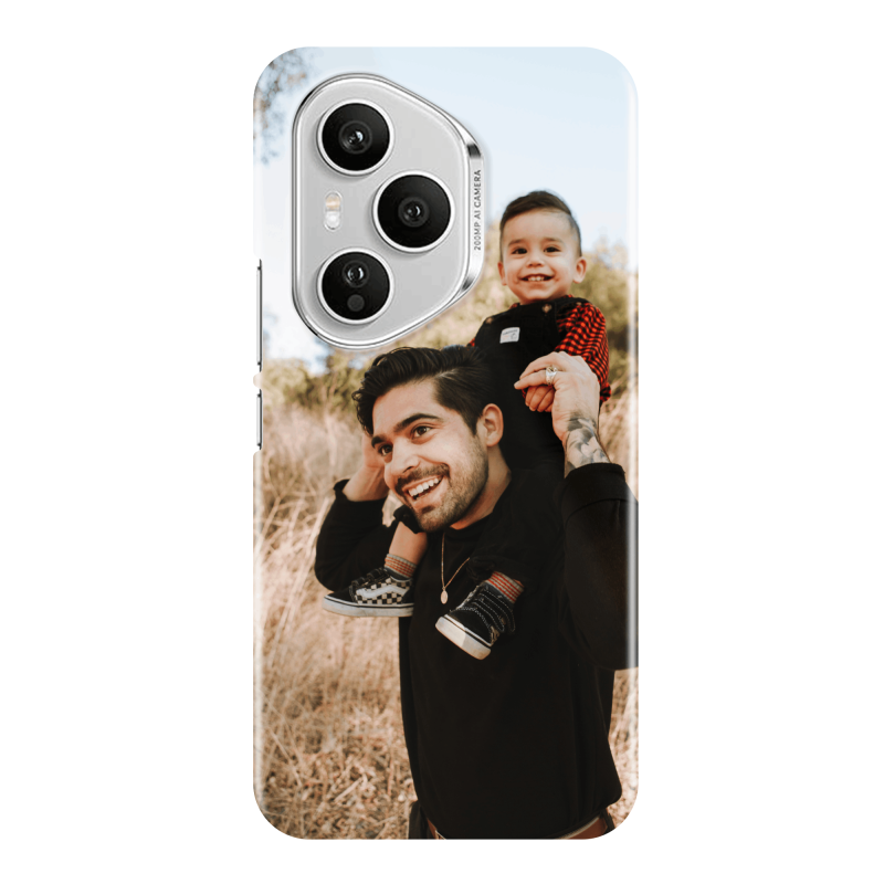 Coque personnalisée Honor 400 Pro