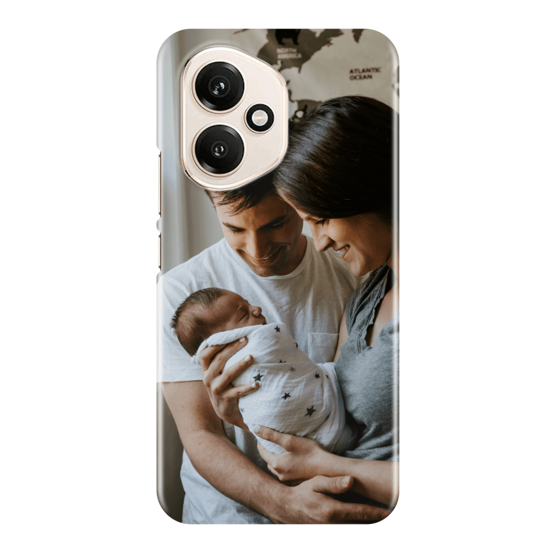 Coque personnalisée Honor 400